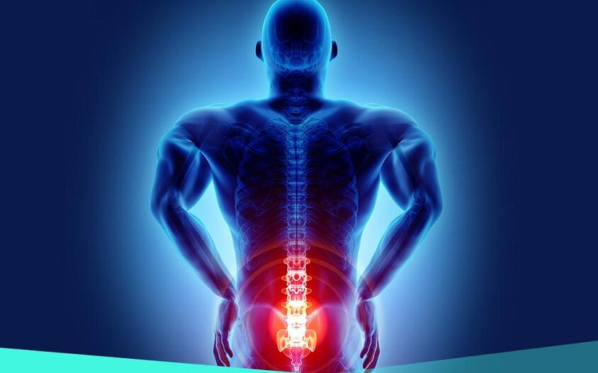 bolesť v dôsledku artrózy bedrového kĺbu